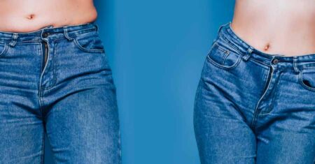 Qual É A Diferença Entre Abdominoplastia E Lipoaspiração?
