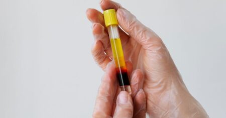 Qual É A Diferença Entre Soro E Plasma?