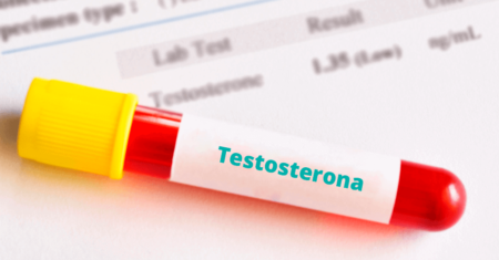 Qual É A Diferença Entre Testosterona Livre E Total?