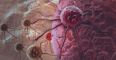 Qual É A Diferença Entre Tumor E Câncer?
