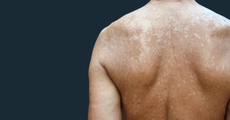 O Que Significa Sonhar Com Pano Branco?