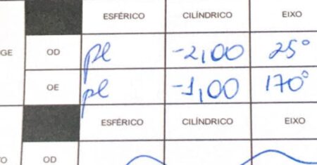 O Que Significa Cilíndrico Na Receita De Óculos?